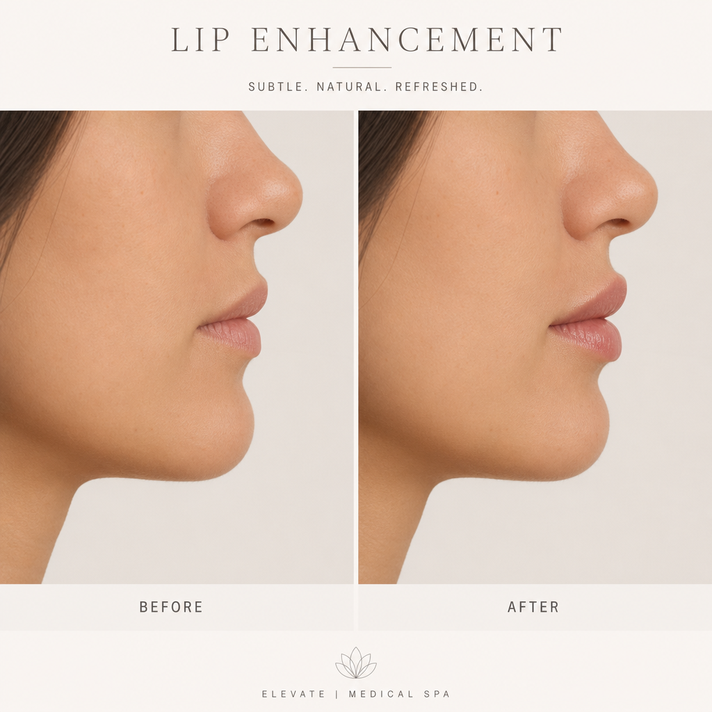 Side-by-side profile comparison of natural lip enhancement results